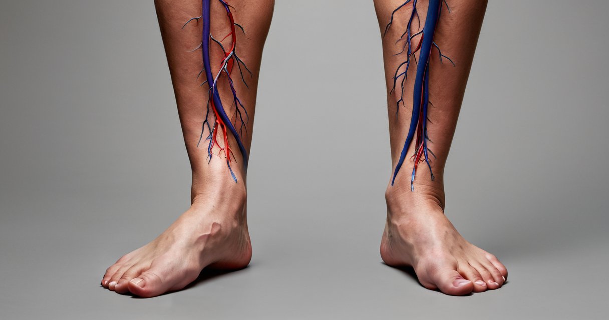 Come mantenere elasticità delle vene — Cause della perdita di elasticità venosa Come mantenere elasticità delle vene — Cause della perdita di elasticità venosa